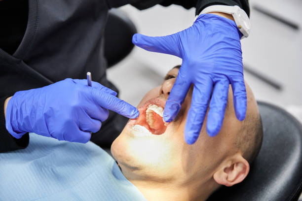 Best Broken or Chipped Tooth Repair in Irondale, GA